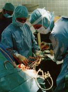 Epilepsy surgery